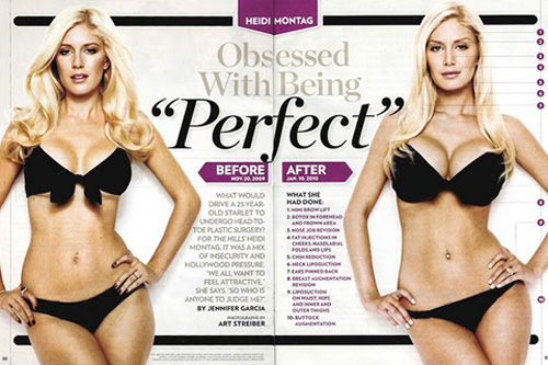 Heidi Recalls Plastic Surgery Horrors