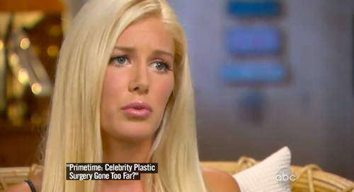 heidi montag surgery gone wrong. Tagged: Plastic Surgery