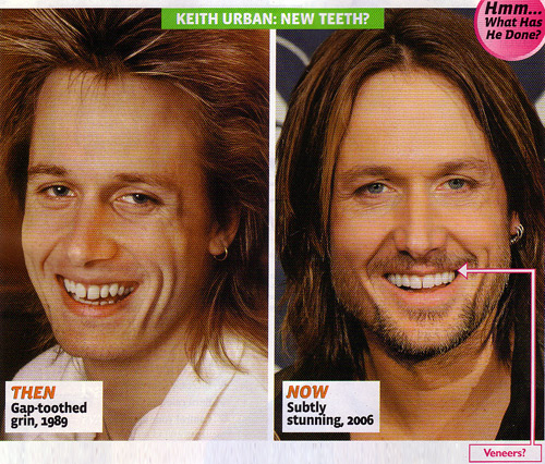 This says That Keith Has Gotten new teeth from 1989 to 2006 I do not think 