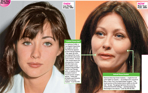 picking apart shannen doherty's face