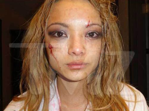 Tila Tequila Attacked